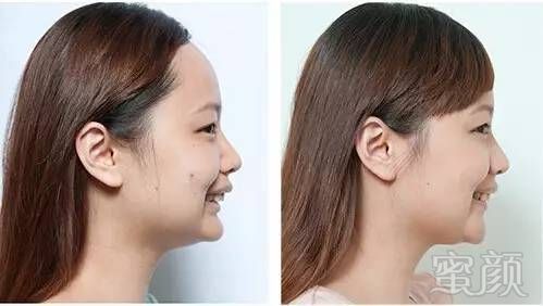 https://img.miyanlife.com/mnt/timg/170702/191054F37-5.jpg