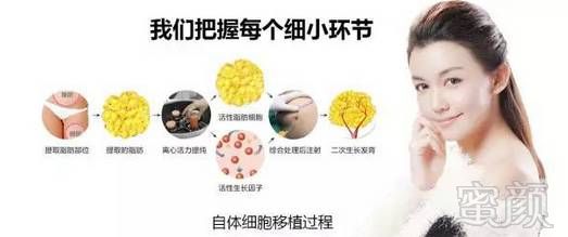 https://img.miyanlife.com/mnt/timg/170702/1R9332919-5.jpg