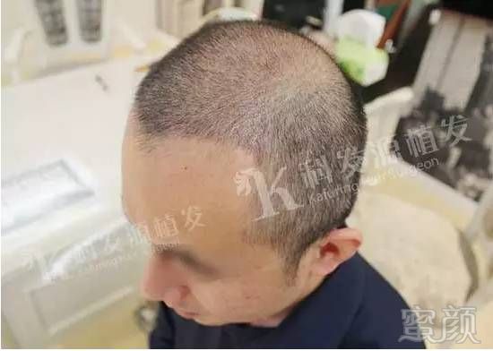 https://img.miyanlife.com/mnt/timg/170703/0922292c8-6.jpg