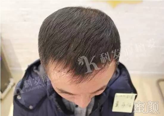 https://img.miyanlife.com/mnt/timg/170703/0922293393-7.jpg