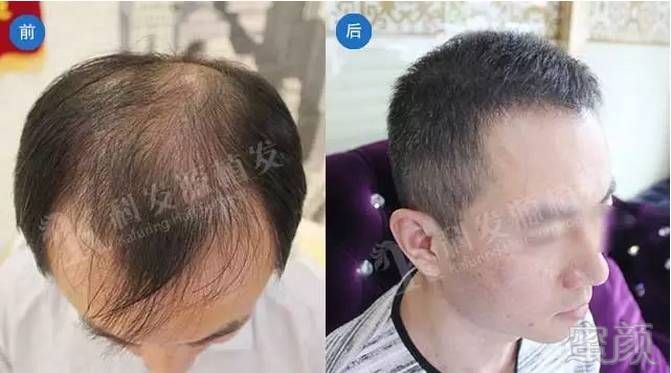 https://img.miyanlife.com/mnt/timg/170703/09222C625-0.jpg
