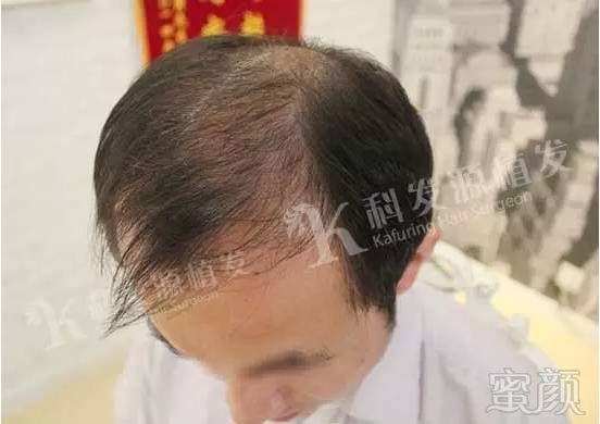 https://img.miyanlife.com/mnt/timg/170703/09222HK9-2.jpg