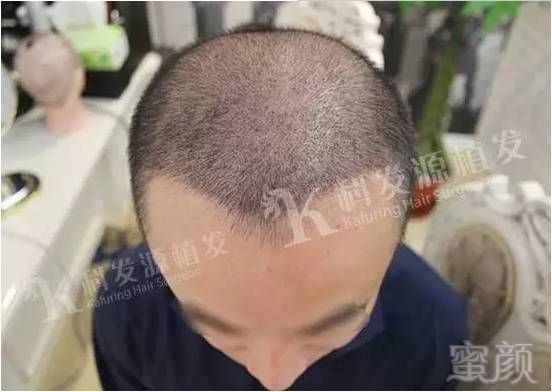 https://img.miyanlife.com/mnt/timg/170703/09222Ta8-5.jpg