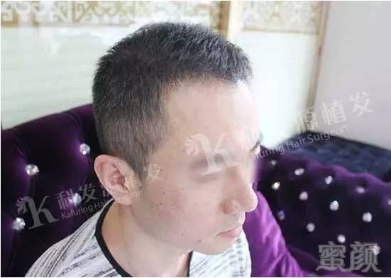 https://img.miyanlife.com/mnt/timg/170703/0922301264-9.jpg