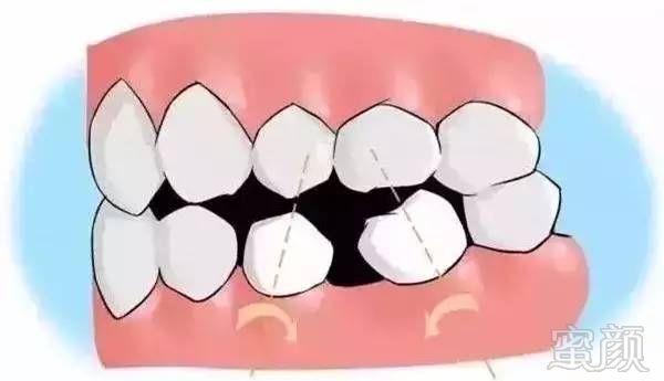 https://img.miyanlife.com/mnt/timg/170703/1I2331105-6.jpg