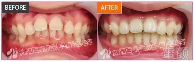 https://img.miyanlife.com/mnt/timg/170703/1I2344B8-10.jpg