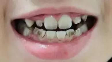 https://img.miyanlife.com/mnt/timg/170703/1I234I45-8.jpg