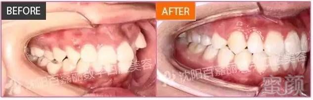 https://img.miyanlife.com/mnt/timg/170703/1I234L41-11.jpg
