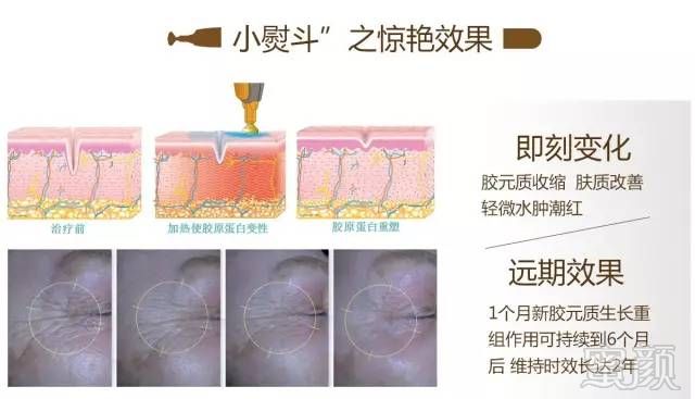 案例图片