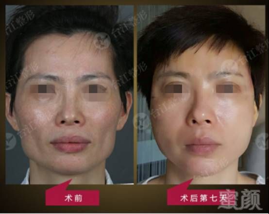 https://img.miyanlife.com/mnt/timg/170703/1Q4316154-7.jpg