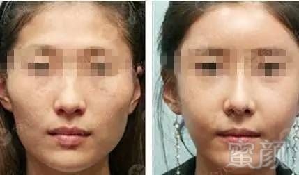 https://img.miyanlife.com/mnt/timg/170703/1Q431J54-8.jpg