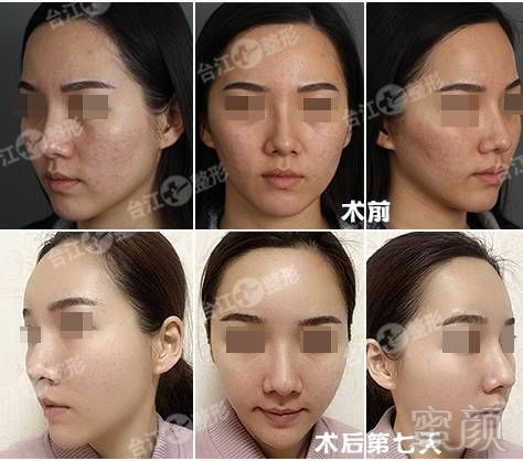 https://img.miyanlife.com/mnt/timg/170703/1Q4324603-9.jpg