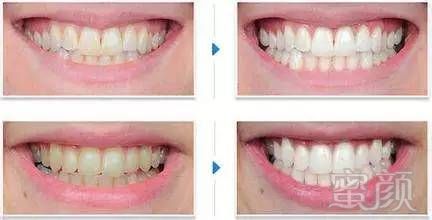 https://img.miyanlife.com/mnt/timg/170703/1T041G23-5.jpg