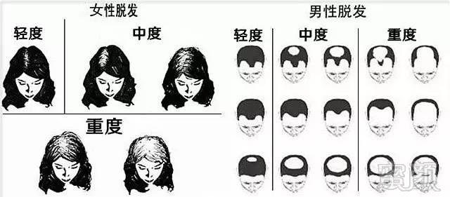 https://img.miyanlife.com/mnt/timg/170704/1S00023U-2.jpg