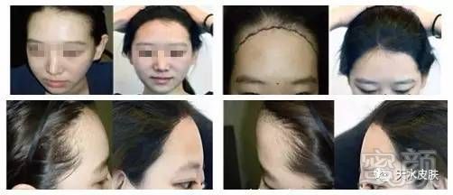 https://img.miyanlife.com/mnt/timg/170704/1S0014Z0-6.jpg