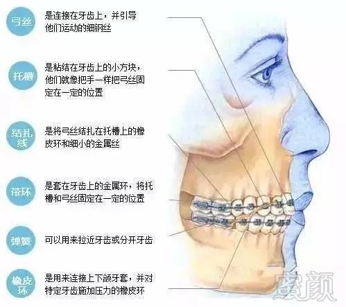 https://img.miyanlife.com/mnt/timg/170705/103214KY-8.jpg