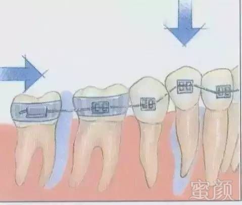 https://img.miyanlife.com/mnt/timg/170705/1032153Q0-11.jpg