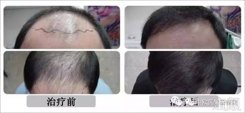 https://img.miyanlife.com/mnt/timg/170705/1233352W2-5.jpg