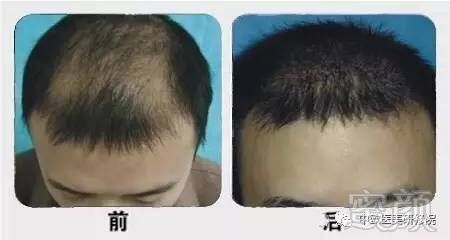 https://img.miyanlife.com/mnt/timg/170705/1233355W6-4.jpg