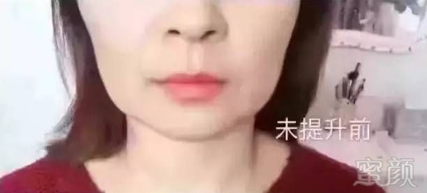 案例图片