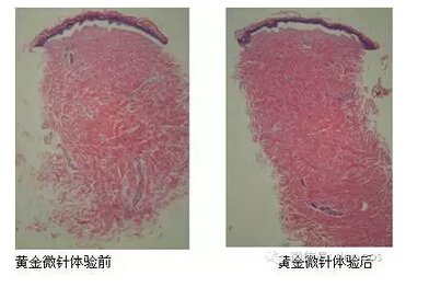 案例图片