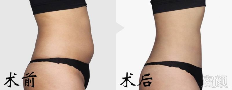 https://img.miyanlife.com/mnt/timg/170705/22310G0Q-1.jpg