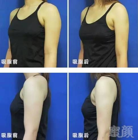 https://img.miyanlife.com/mnt/timg/170705/22310UM8-3.jpg