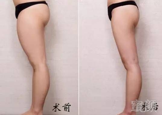 https://img.miyanlife.com/mnt/timg/170705/22310W511-5.jpg
