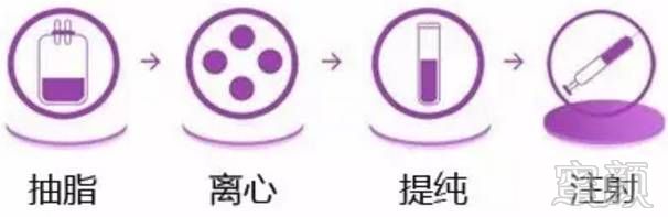 https://img.miyanlife.com/mnt/timg/170705/2322214a6-0.jpg