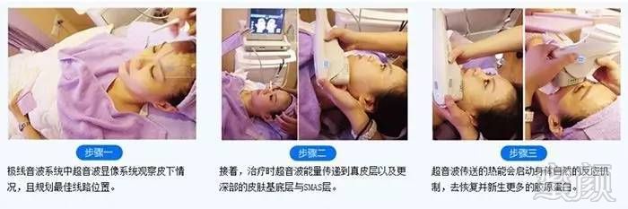 案例图片