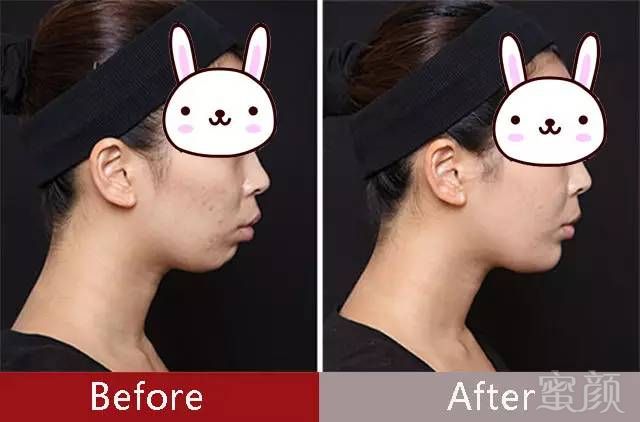 https://img.miyanlife.com/mnt/timg/170706/1642491027-4.jpg