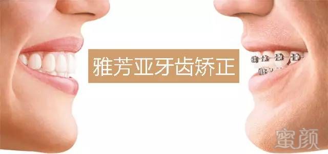 https://img.miyanlife.com/mnt/timg/170706/16424TO1-2.jpg