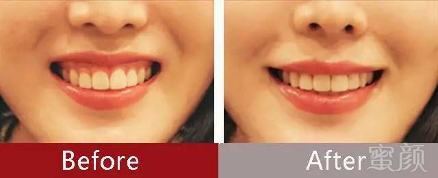 https://img.miyanlife.com/mnt/timg/170706/1642501000-8.jpg