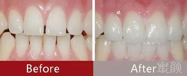 https://img.miyanlife.com/mnt/timg/170706/1642515352-12.jpg