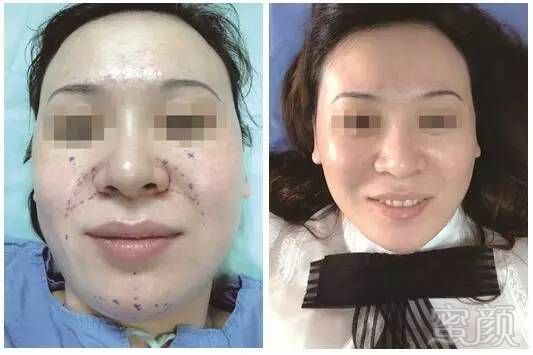https://img.miyanlife.com/mnt/timg/170706/1G2292101-0.jpg