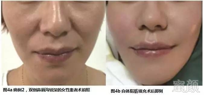 https://img.miyanlife.com/mnt/timg/170706/1G2312237-5.jpg