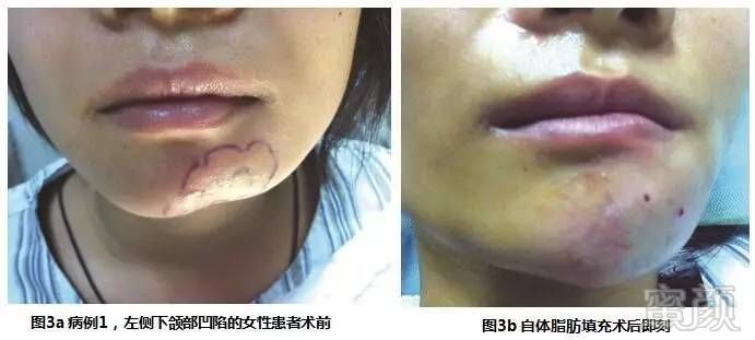 https://img.miyanlife.com/mnt/timg/170706/1G2313S0-4.jpg