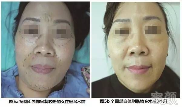 https://img.miyanlife.com/mnt/timg/170706/1G2322594-7.jpg