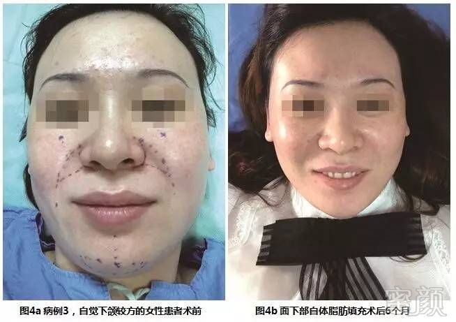 https://img.miyanlife.com/mnt/timg/170706/1G2323361-6.jpg