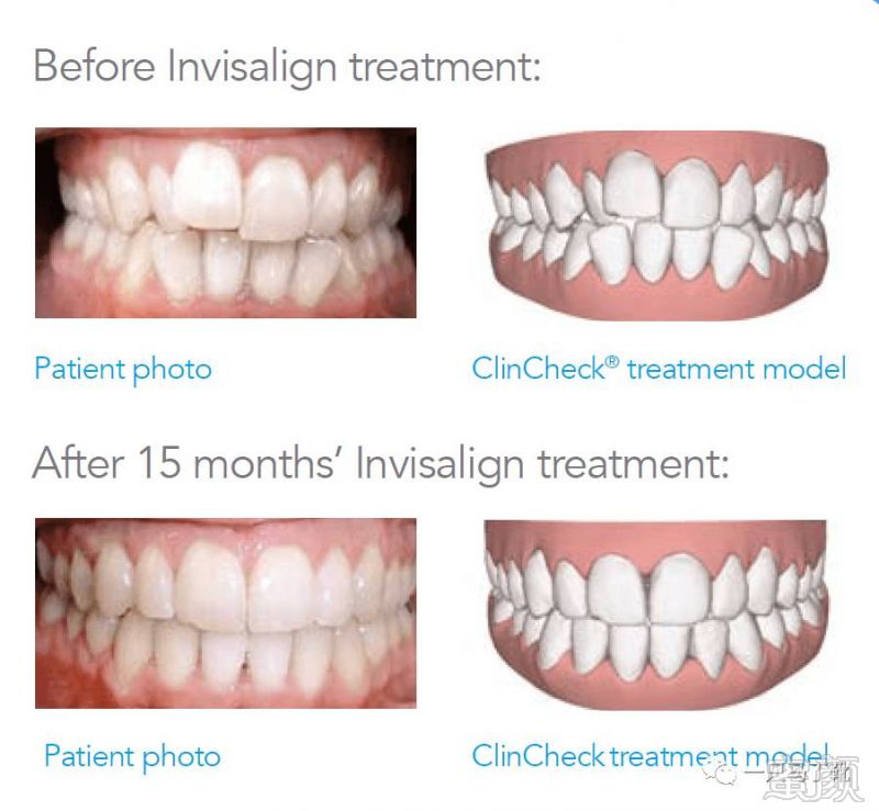 https://img.miyanlife.com/mnt/timg/170706/1H2322Y0-8.jpg