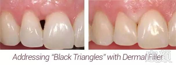 https://img.miyanlife.com/mnt/timg/170706/1H2334240-9.jpg