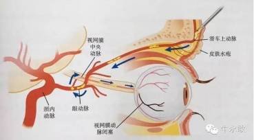 案例图片