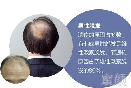https://img.miyanlife.com/mnt/timg/170710/1911131639-3.jpg