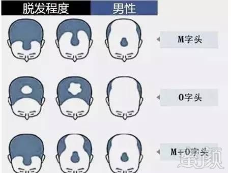 https://img.miyanlife.com/mnt/timg/170710/191113K44-5.jpg
