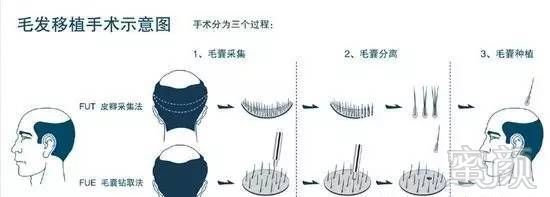 https://img.miyanlife.com/mnt/timg/170710/1911141016-7.jpg