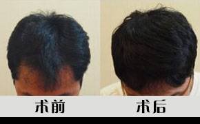 https://img.miyanlife.com/mnt/timg/170711/20203I005-10.jpg