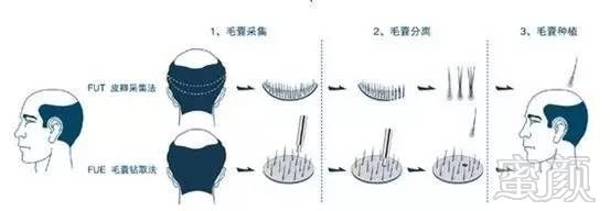 https://img.miyanlife.com/mnt/timg/170711/20203Kb0-9.jpg