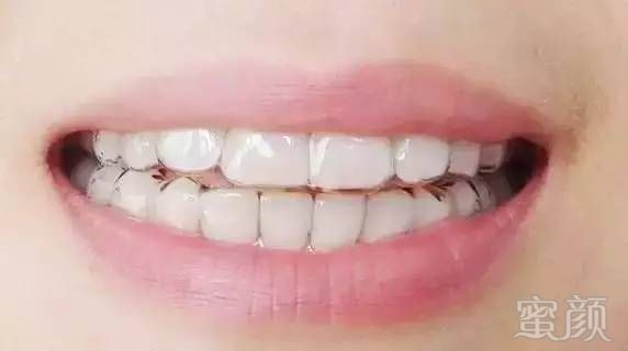https://img.miyanlife.com/mnt/timg/170711/2033503021-7.jpg