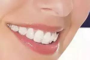 https://img.miyanlife.com/mnt/timg/170711/2033503418-8.jpg
