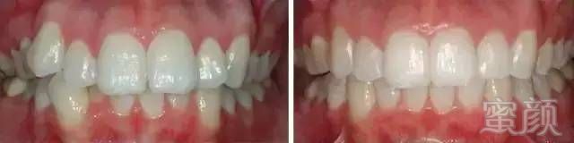 https://img.miyanlife.com/mnt/timg/170711/203351BU-11.jpg